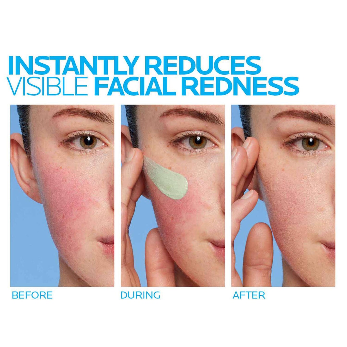 toleriane-rosaliac-ar-face-cream-for-visible-redness-f9 8_Toleriane_Rosaliac-AR-before-after.jpg