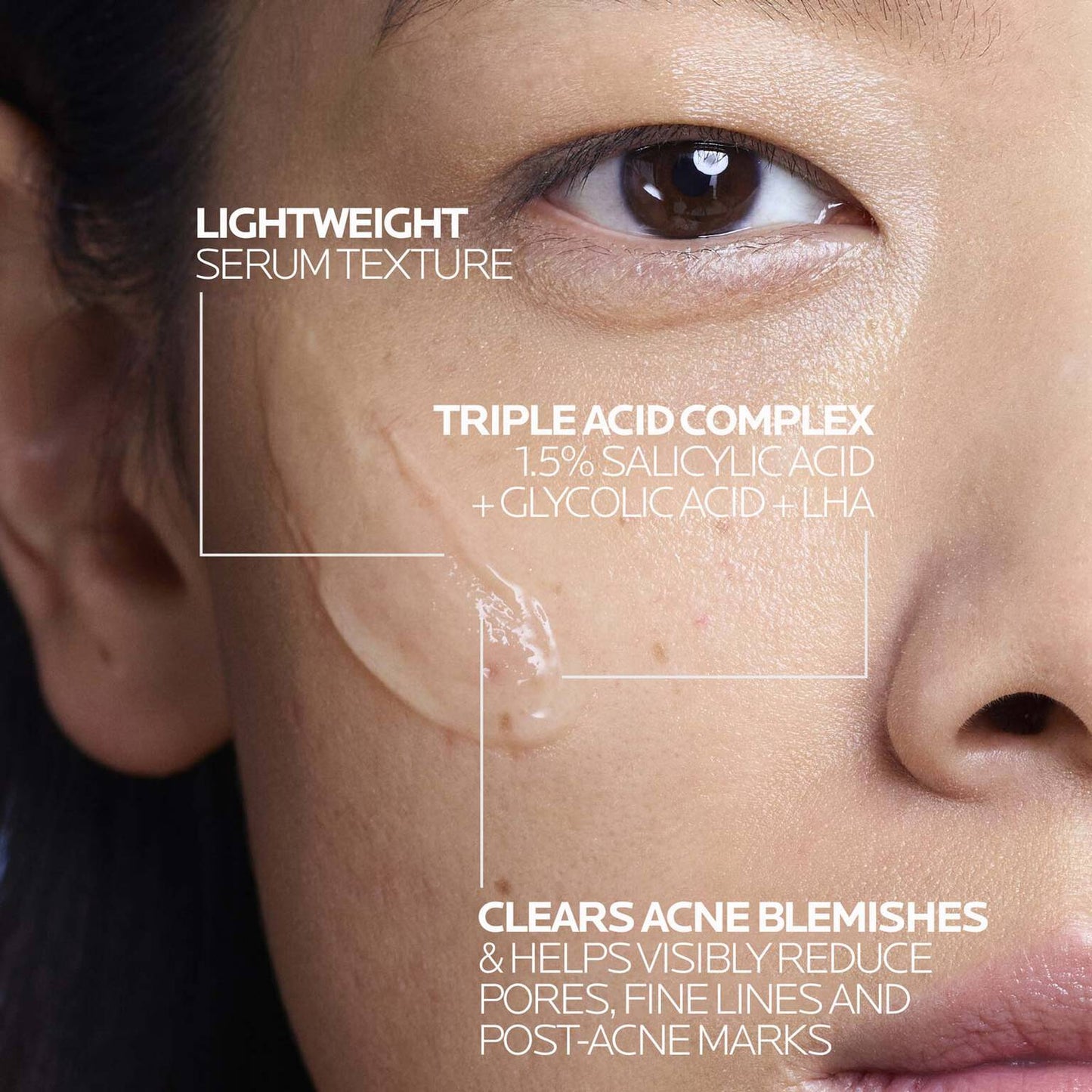 effaclar-salicylic-acid-acne-treatment-serum-v3 LaRochePosay-Product-Effaclar-Effaclar-Serum-30ml-3337875722827-Texture-REV.jpg
