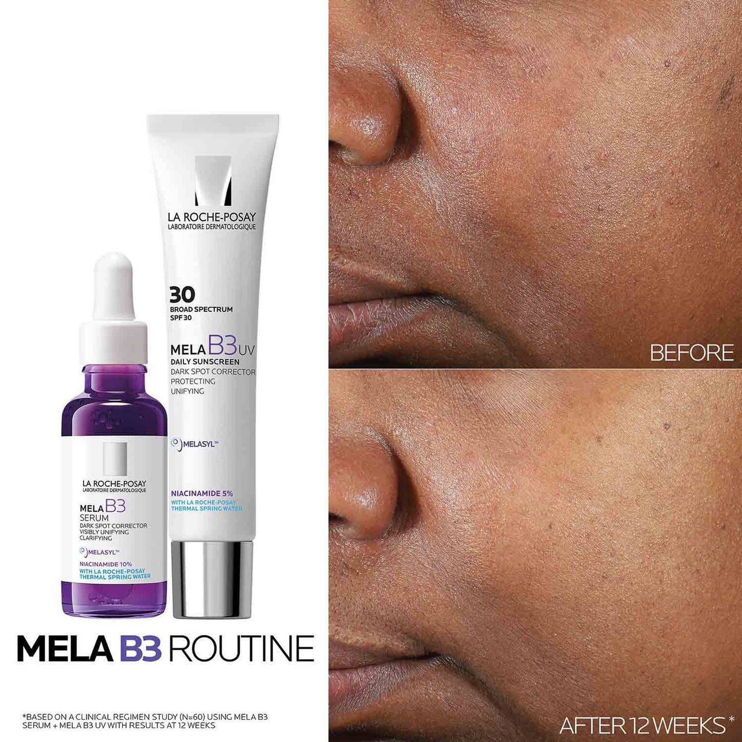 mela-b3-dark-spot-serum-with-melasyltm-niacinamide-i0 Mela-B3-routine_1500X1500.jpg