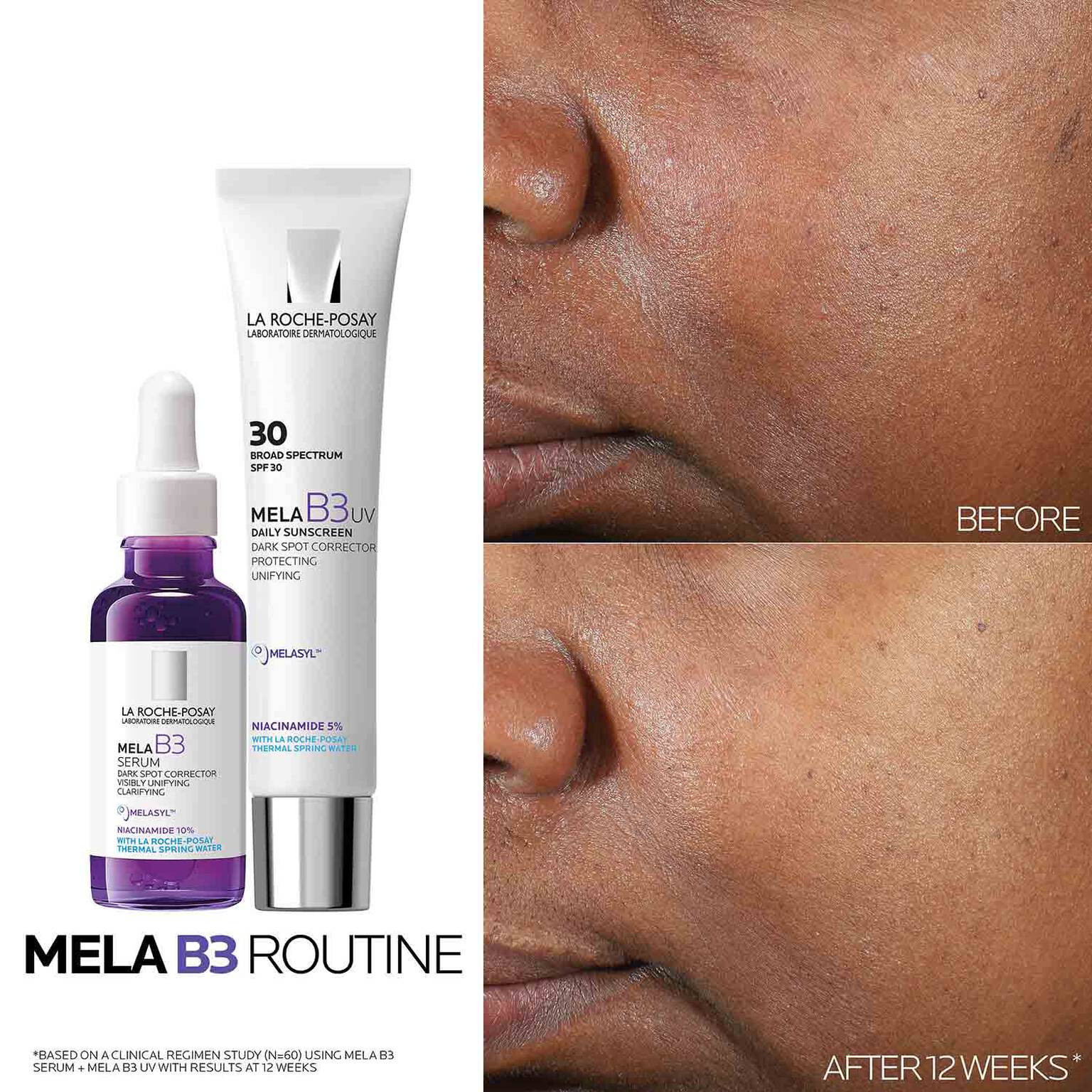 mela-b3-dark-spot-serum-with-melasyltm-niacinamide-i0 Mela-B3-routine_1500X1500.jpg