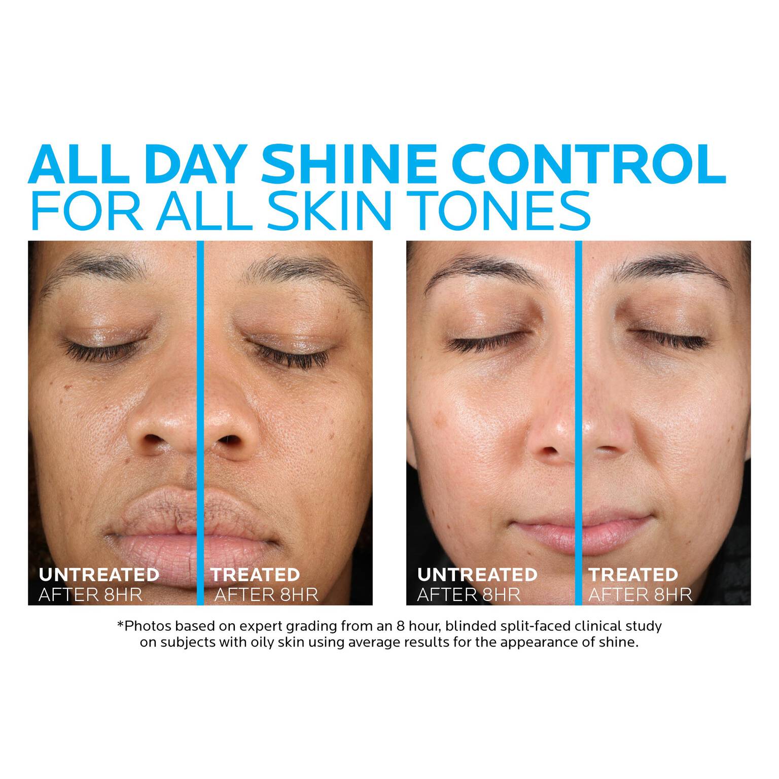 toleriane-double-repair-matte-face-moisturizer-for-oily-skin-p5 la-roche-posay-toleriane-matte-moisturizer-before-and-after-pdp-alt.jpg